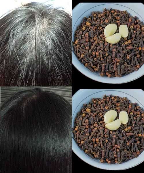 Restore Your Natural Hair Color with Garlic and Clove: A Natural Solution