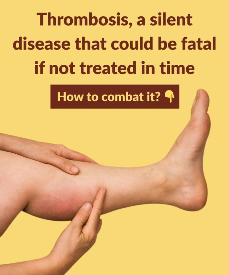 The 6 Best Infusions To Keep Your Arteries Healthy