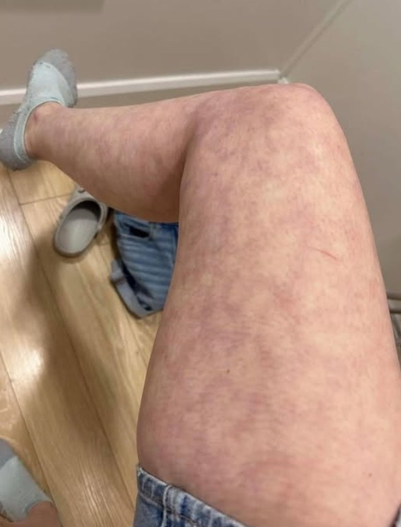 Here are the consequences of sleeping with… Show more