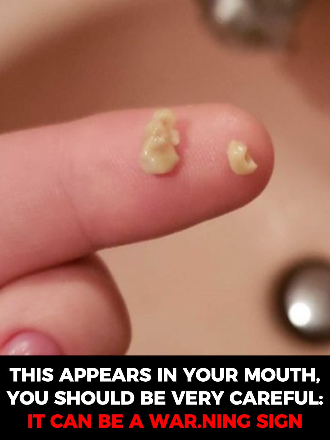 This appears in your mouth, you should be very careful: it can be a war.ning sign