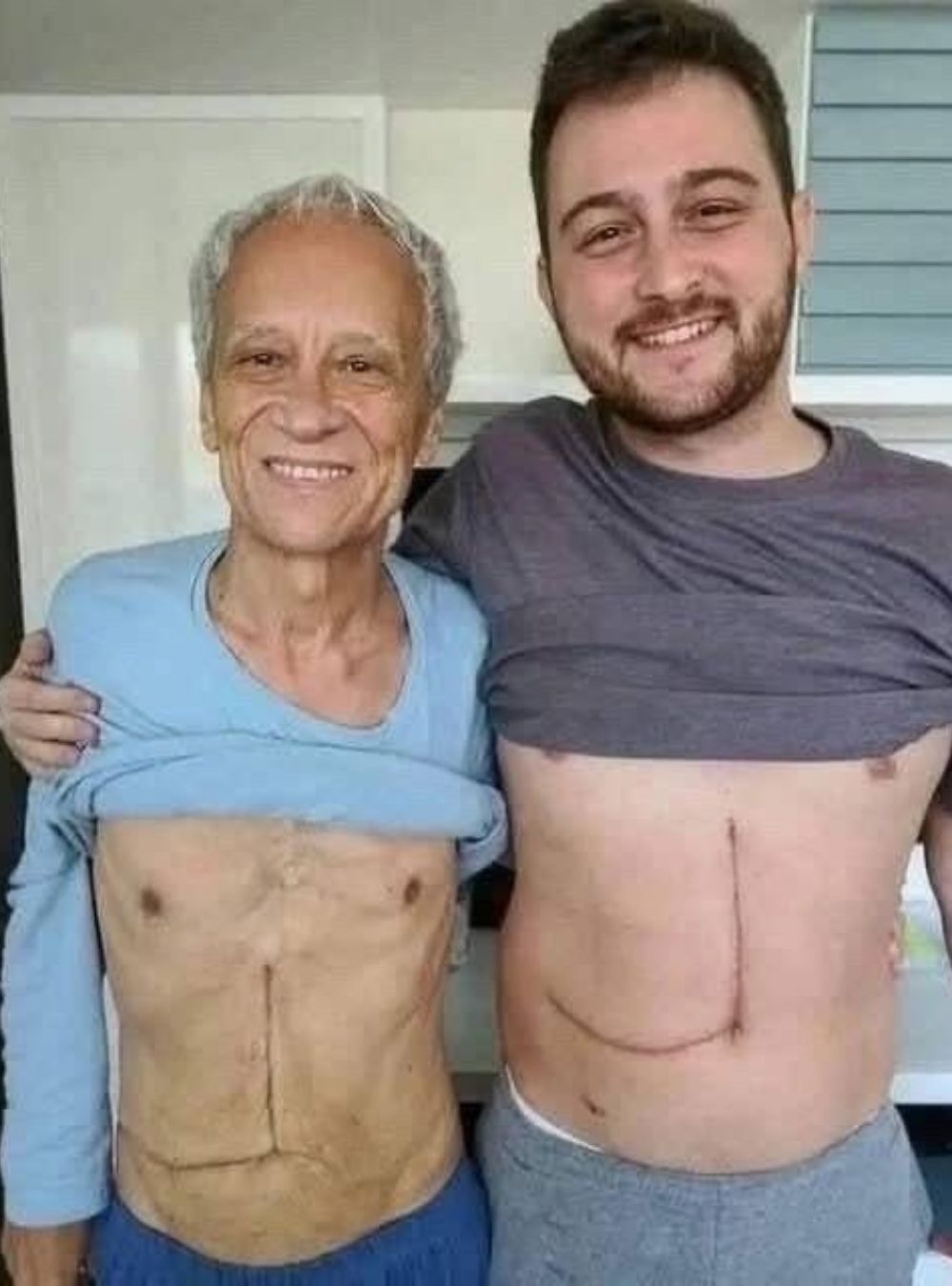 Son Who Donated Part of His Liver to Save His Father Now Faces Serious Health Complications